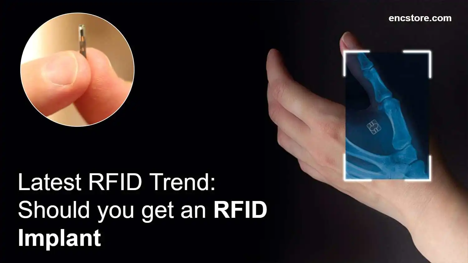 RFID Implant